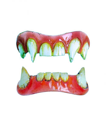 Dental FX Veneers Hyde-Zähne